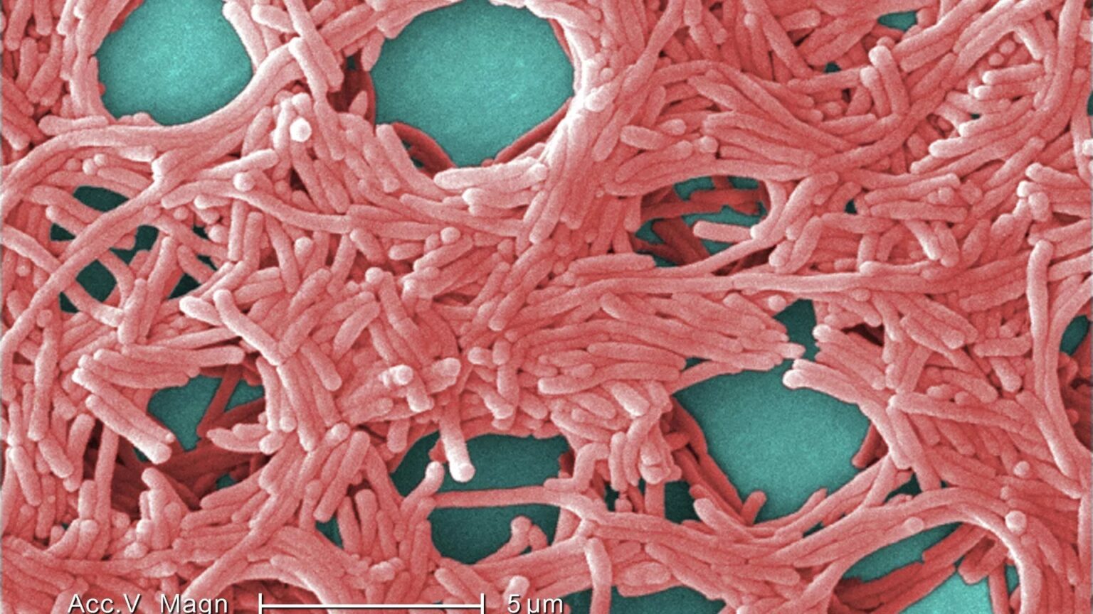 Legionella